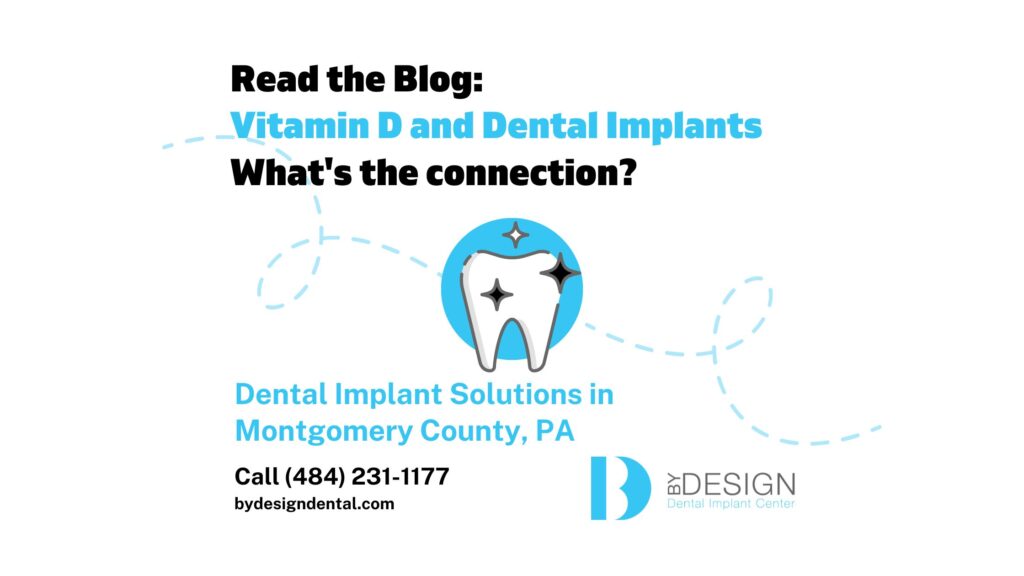 Vitamin D and Dental implants