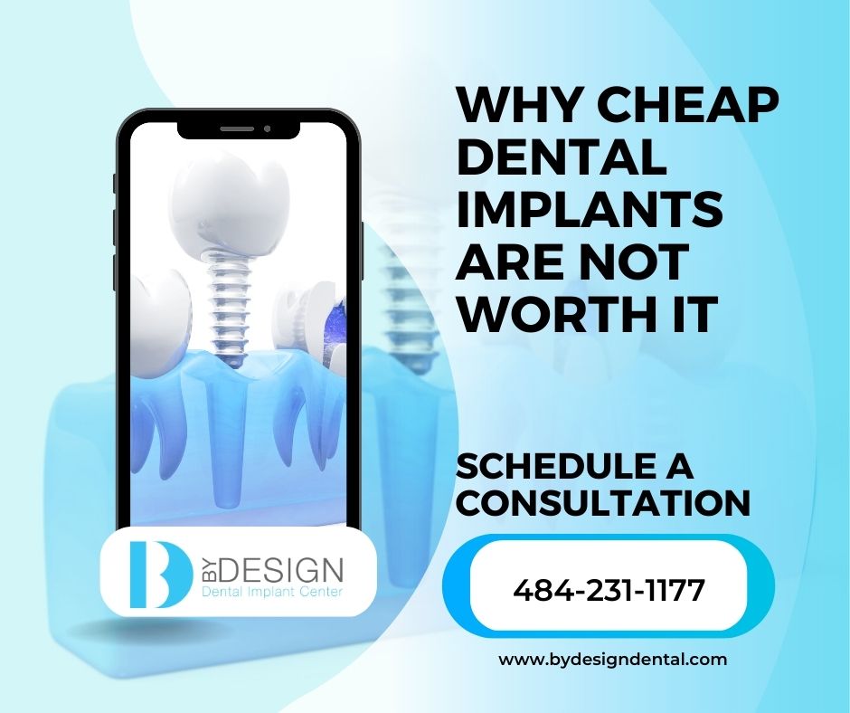 Why Cheap Dental Implants are Not Worth It.